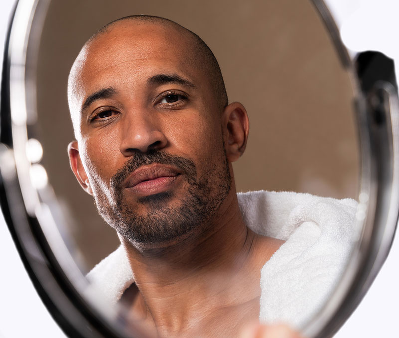 man-looking-at-himself-in-the-mirror Hair Loss Treatment